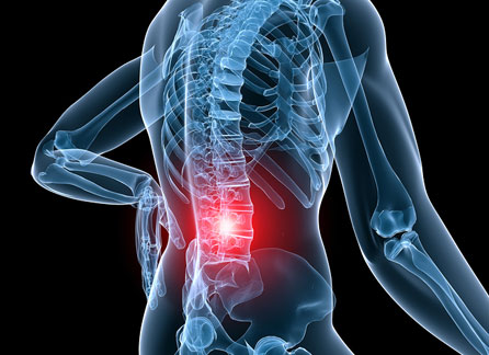 Bulging Disc Surgery