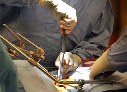 Wellington Spinal Unit Disc Surgery Wellington Spinal Unit Disc Surgery